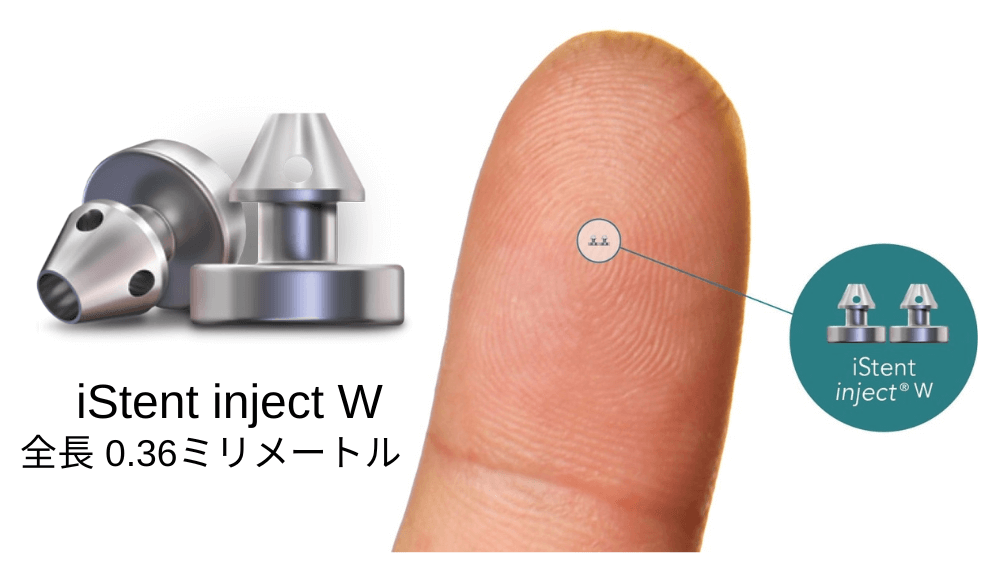 iStent inject W