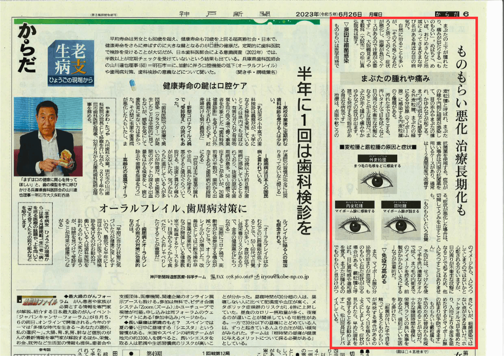 ものもらい-神戸新聞
